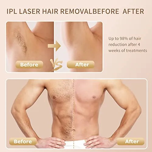 Aopvui Laser Hair Removal Device for Women and Men, 3-in-1 Upgraded 999,900  Flashes at-Home IPL Hair Removal Device, Laser Hair Removal with 2 Mode 9 Energy Levels