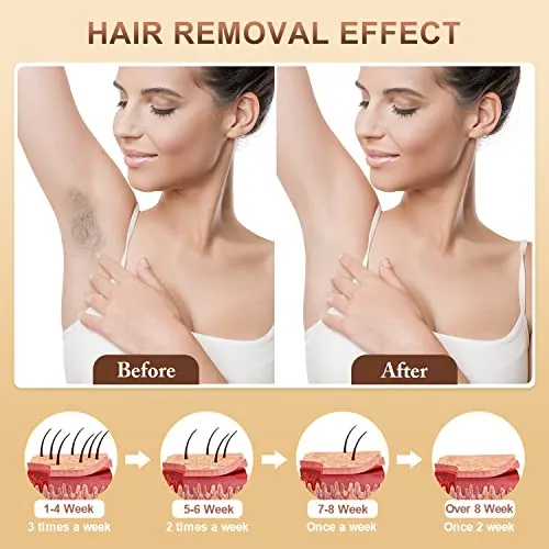 Aopvui Laser Hair Removal Device for Women and Men, 3-in-1 Upgraded 999,900  Flashes at-Home IPL Hair Removal Device, Laser Hair Removal with 2 Mode 9 Energy Levels